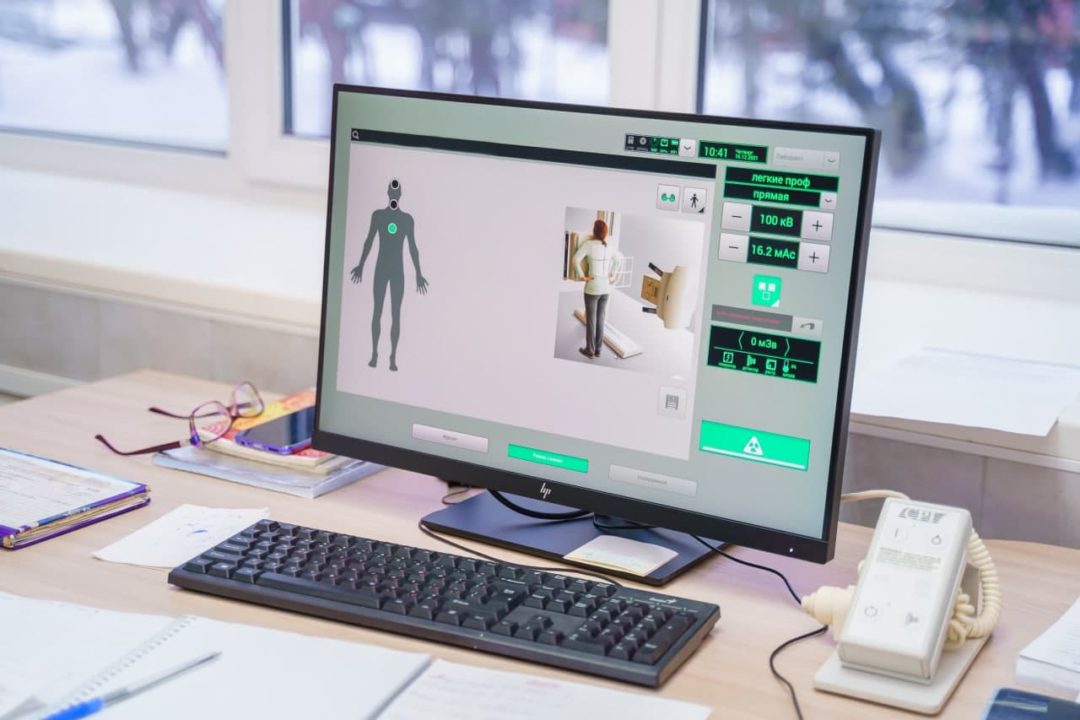 Цифровой флюорограф начал работать в поликлинике № 3 Юргинской городской больницы